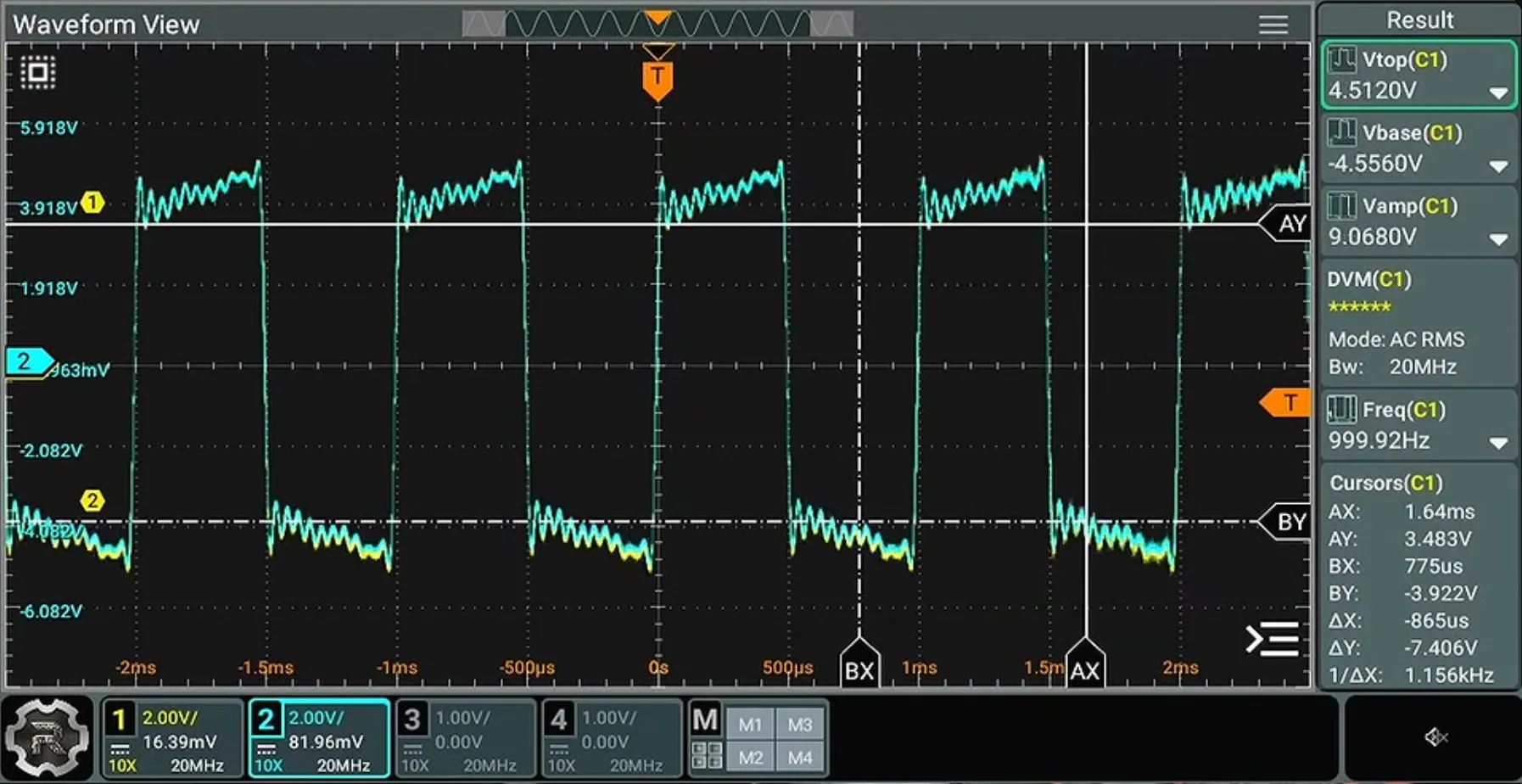A scope screen showing a 1 kHz square wave swinging from about −4.6 V to +4.5 V. Every top and bottom is covered in a fine sawtooth-like ripple from one edge to the next, and every top climbs, and every bottom falls, by about 1 V between edges.